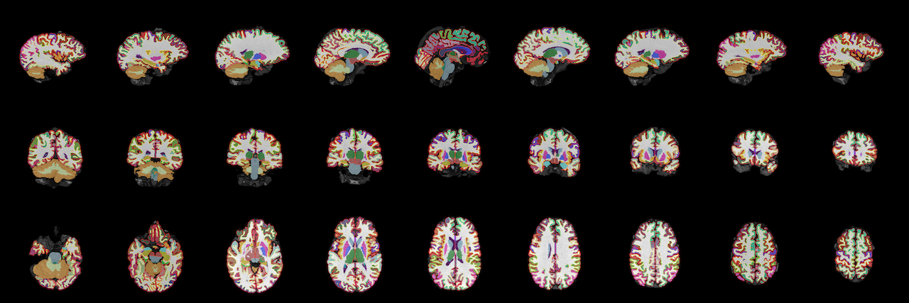 Aparc+aseg screenshot mosaic